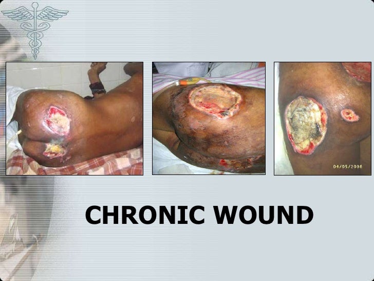 Luka Wound Healing Dr Yuda Umm